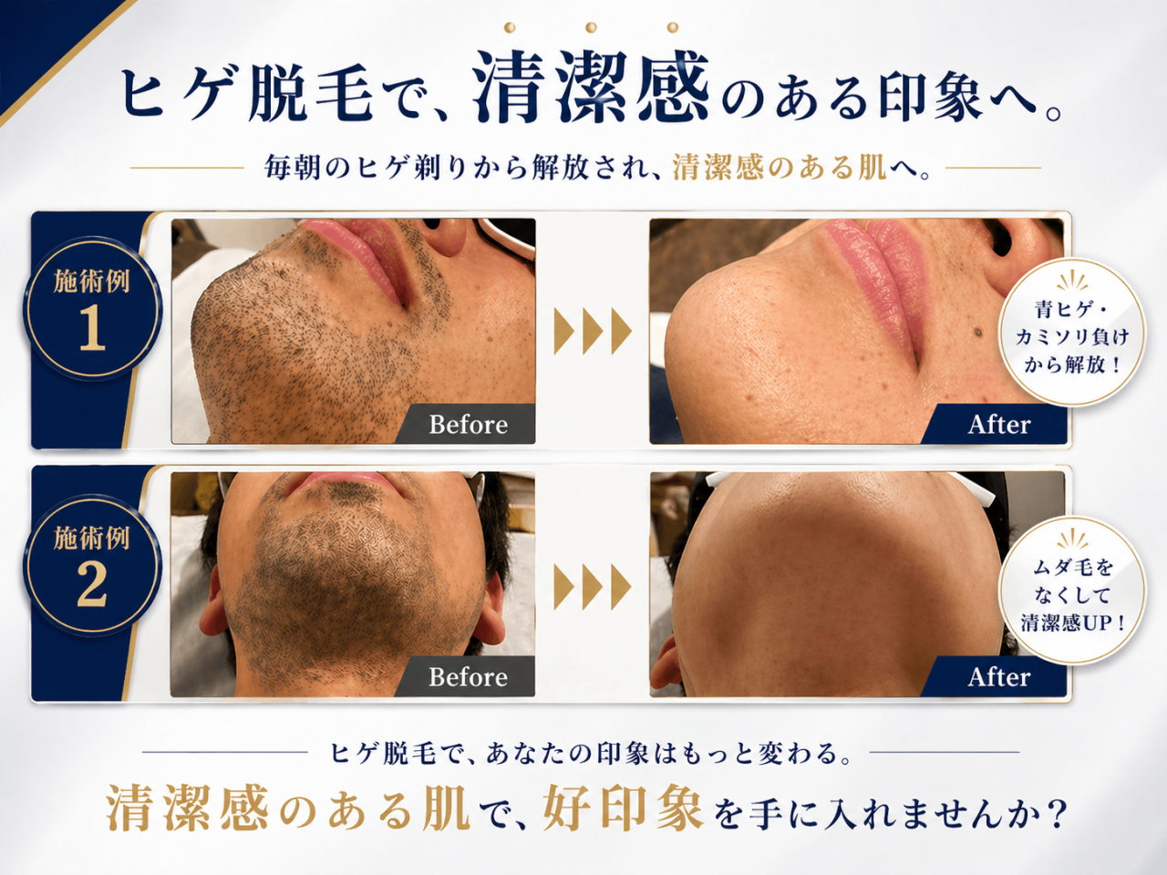 men's脱毛サロン BASE