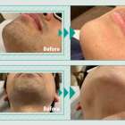 香芝でメンズ脱毛を考えている方へ｜後悔しない選び方